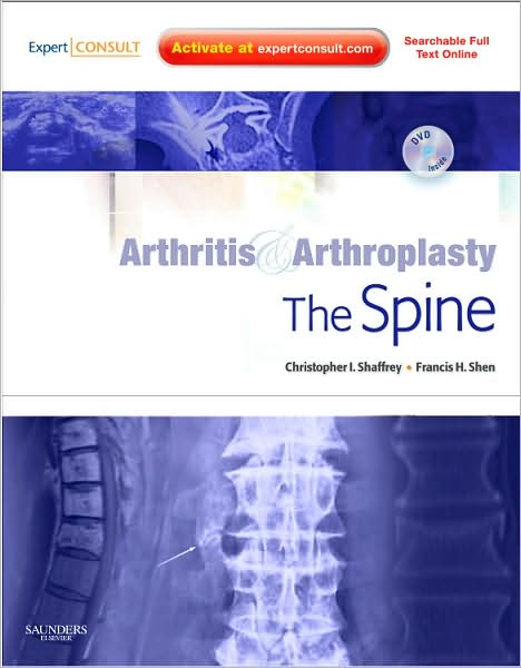 Arthritis Arthroplasty the spine