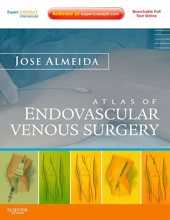 Atlas of endovascular venous surg