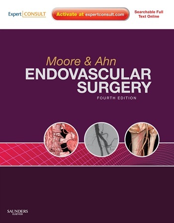 Endovascular surgery 4