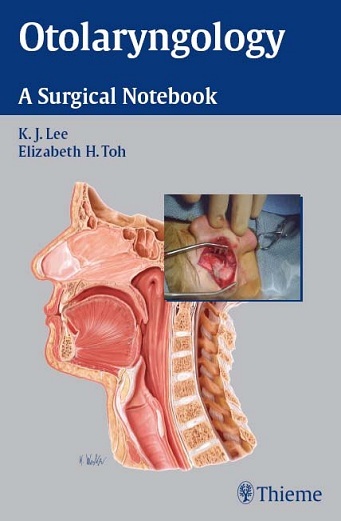 Otolaryngology a surgical notebook