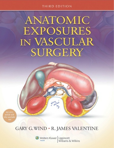 Anatomic Exposures in vascular surgery 3