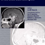 Chordomas and Chondrosarcomas of the Skull Base and Spine