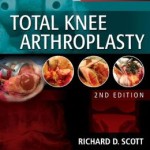 Total Knee Arthroplasty 2nd Edition