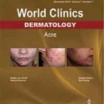 Dermatology: Acne