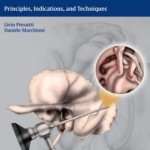 Endoscopic Ear Surgery: Principles, Indications, and Techniques