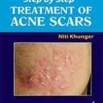 Step by Step® Treatment of Acne Scars
