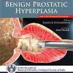 Common Urologic Problems: Benign Prostatic Hyperplasia