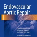 Endovascular Aortic Repair 2017 : Current Techniques with Fenestrated, Branched and Parallel Stent-Grafts