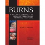 Burns : A Practical Approach to Immediate Treatment and Long Term Care