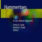 Hammertoes : A Case-Based Approach
