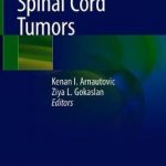 Spinal Cord Tumors