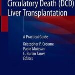 Donation after Circulatory Death (DCD) Liver Transplantation : A Practical Guide