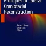Principles of Lateral Craniofacial Reconstruction