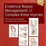 Evidence-Based Management of Complex Knee Injuries : Restoring the Anatomy to Achieve Best Outcomes