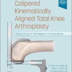 Calipered Kinematically aligned Total Knee Arthroplasty : Theory, Surgical Techniques and Perspectives