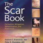The Scar Book : Formation, Mitigation, Rehabilitation and Prevention