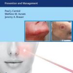 Complications in Minimally Invasive Facial Rejuvenation : Prevention and Management