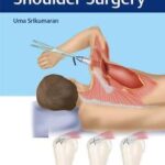 Synopsis of Shoulder Surgery