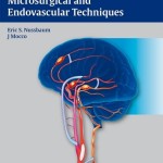 Cerebral Revascularization: Microsurgical and Endovascular Techniques