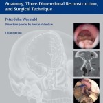 Endoscopic Sinus Surgery: Anatomy, Three-Dimensional Reconstruction, and Surgical Technique, 3rd Edition