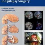 Operative Techniques in Epilepsy Surgery