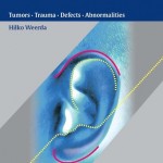 Surgery of the Auricle: Tumors-Trauma-Defects-Abnormalities