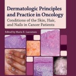 Dermatologic Principles and Practice in Oncology: Conditions of the Skin, Hair, and Nails in Cancer Patients