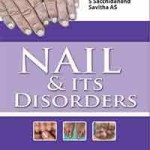 Nail and its Disorders