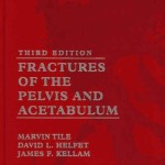 Fractures of the Pelvis and Acetabulum, 3rd Edition