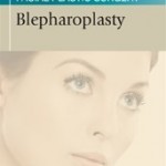 Blepharoplasty: Thomas Procedures in Facial Plastic Surgery