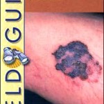 Field Guide to Clinical Dermatology                    / Edition 2