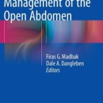 Options in the Management of the Open Abdomen