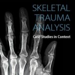 Skeletal Trauma Analysis: Case Studies in Context