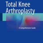 Total Knee Arthroplasty