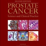 Prostate Cancer: Science and Clinical Practice, 2nd Edition
