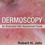 Dermoscopy  :  An Illustrated Self-Assessment Guide, 2/E