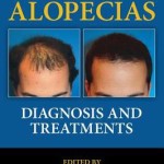 The Alopecias  :  Diagnosis and Treatments