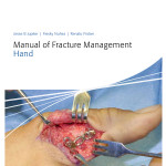 Manual of Fracture Management – Hand