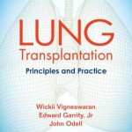 Lung Transplantation  :  Principles and Practice