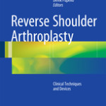 Reverse Shoulder Arthroplasty                            :Biomechanics, Clinical Techniques, and Current Technologies