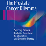 The Prostate Cancer Dilemma                            :Selecting Patients for Active Surveillance, Focal Ablation and Definitive Therapy