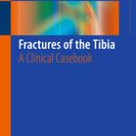 Fractures of the Tibia                            :A Clinical Casebook