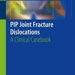 Pip Joint Fracture Dislocations 2016 : A Clinical Casebook
