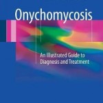 Onychomycosis : An Illustrated Guide to Diagnosis and Treatment