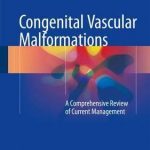 Congenital Vascular Malformations : A Comprehensive Review of Current Management