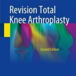 Revision Total Knee Arthroplasty