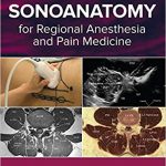 Atlas of Sonoanatomy for Regional Anesthesia and Pain Medicine