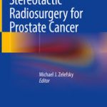 Stereotactic Radiosurgery for Prostate Cancer