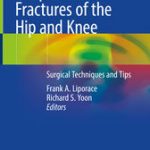 Periprosthetic Fractures of the Hip and Knee