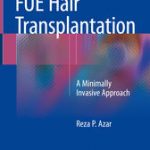 FUE Hair Transplantation